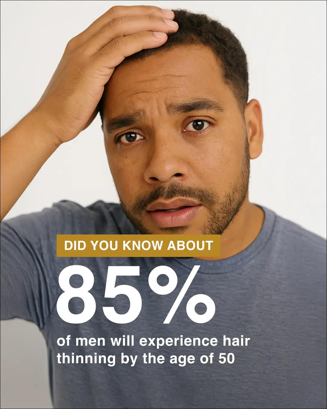 Samson hair thinning statistic creative