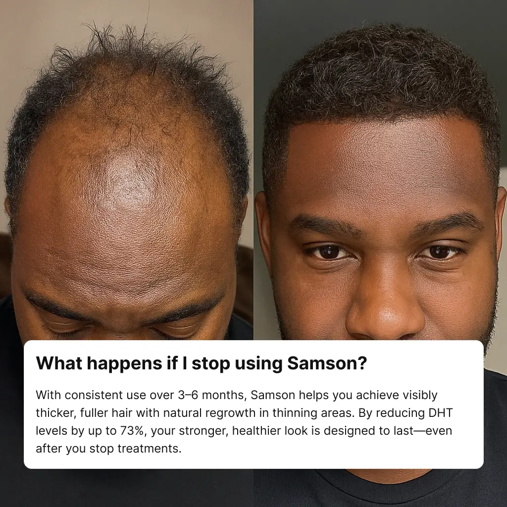 Samson PDP comparison visual